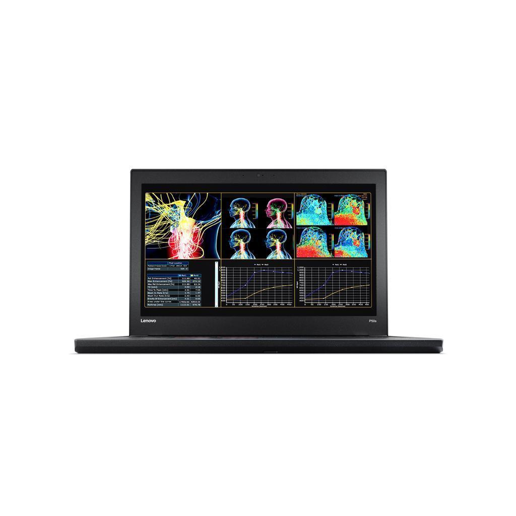 Lenovo Thinkpad T450 14" Core I5 2.3 Ghz - Ssd 180 Go - 8 Go Azerty - Français