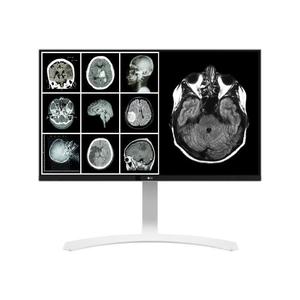Monitor 27" LED 4K UHD LG 27HJ712C-W